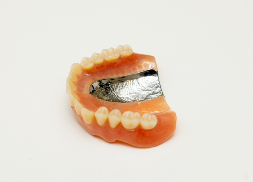 金属床デンチャー｜うつのみや歯科