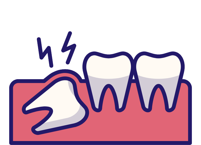 抜歯が必要になるケース｜うつのみや歯科